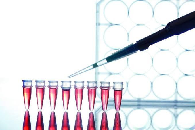 De forma pioneira Laboratório Dr. Lacyr está fazendo testes para o novo Coronavirus