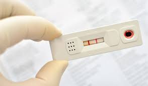 Falta de testes em Minas dá a falsa sensação de pandemia controlada. Além Paraíba já teve 20 confirmados.