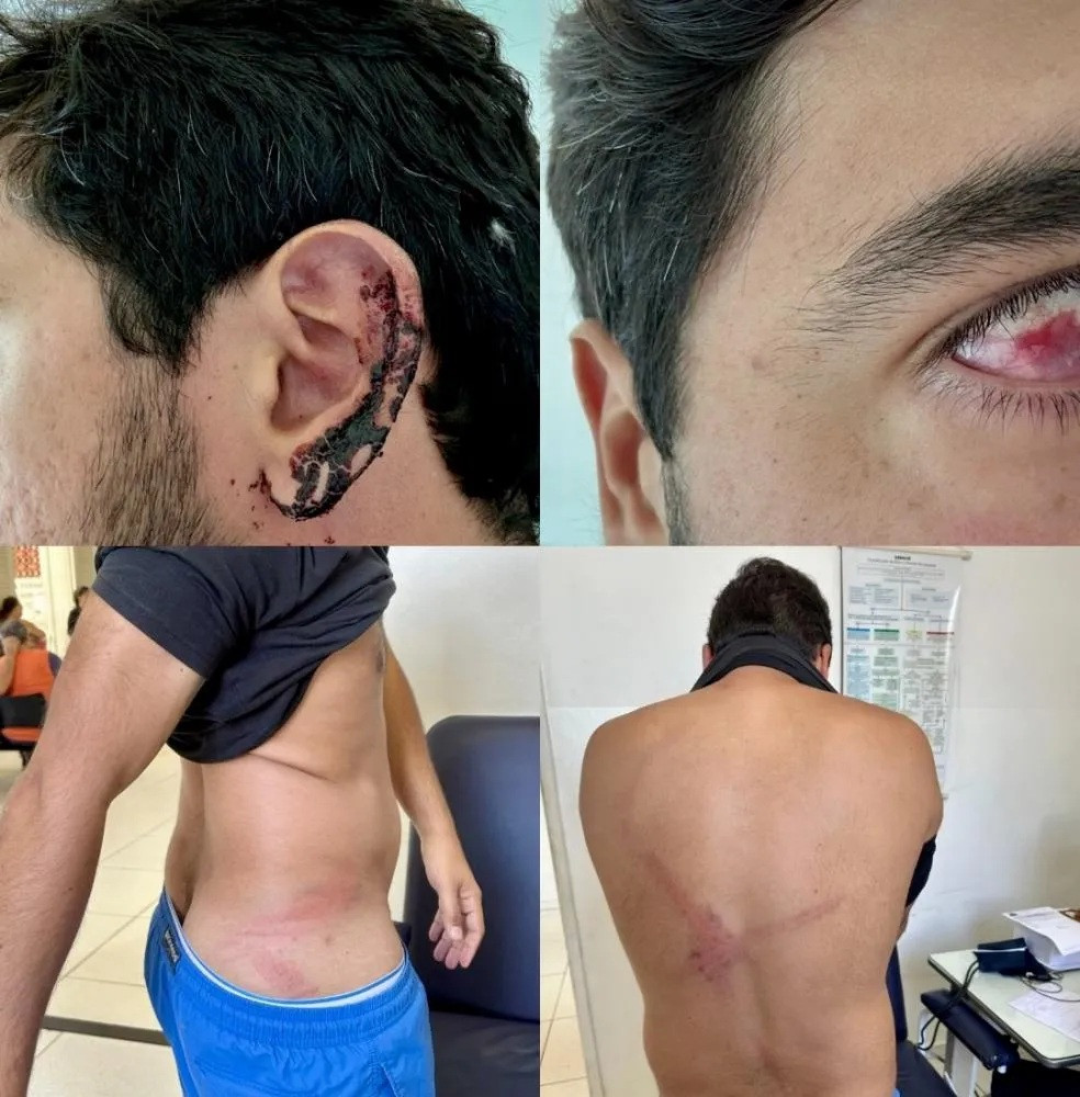 DENÚNCIA DOS JOVENS ALÉM-PARAIBANOS AGREDIDOS PELA PM, NO CARMO, ESTÁ EM APURAÇÃO